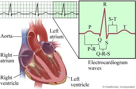 Picture of the intervals and components of an EKG (electrocardiogram)
