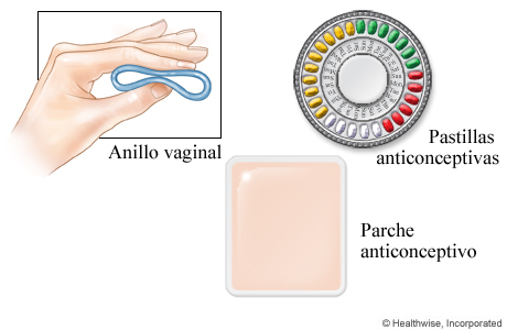 Métodos anticonceptivos hormonales | Cigna