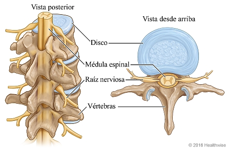 Vista posterior y vista superior de sección de la columna, donde se muestran los discos, la médula espinal, las raíces nerviosas y las vértebras