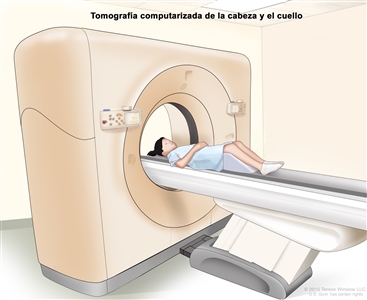 Tomografía computarizada (TC) de la cabeza y el cuello; en el dibujo se muestra un niño acostado sobre una camilla que se desliza a través de un escáner de TC que toma imágenes radiográficas del interior de la cabeza y el cuello.