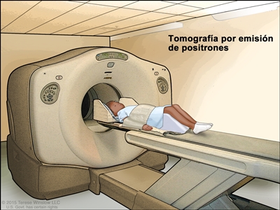 Tomografía por emisión de positrones (TEP); en la imagen se observa un niño acostado en una camilla que se desliza a través del escáner de TEP.