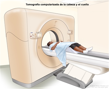 Tomografía computarizada (TC) de la cabeza y el cuello; en el dibujo se muestra un paciente acostado sobre una camilla que se desliza a través de un escáner de TC que toma imágenes radiográficas del interior de la cabeza y el cuello.