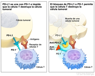 Inhibidor de puntos de control inmunitario; en el panel de la izquierda se muestra la unión de la proteína PD-L1 (en la célula tumoral) con la proteína PD-1 (en la célula T), lo que impide que las células T destruyan las células tumorales del cuerpo. También se muestra un antígeno de una célula tumoral y un receptor de una célula T. En el panel de la derecha, se muestran inhibidores de puntos de control inmunitario (anti-PD-L1 y anti-PD-1) que impiden la unión de PD-L1 con PD-1, lo que permite que las células T destruyan las células tumorales.