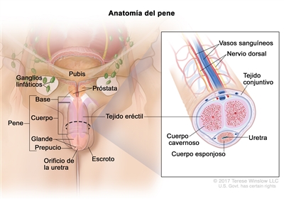 Anatomía del pene; el dibujo muestra la base, el cuerpo, el glande, el prepucio y el orificio de la uretra. También se muestra el escroto, la próstata, el pubis y los ganglios linfáticos. En un recuadro se muestra un corte transversal del interior del pene que incluye los vasos sanguíneos, el nervio dorsal, el tejido conjuntivo, el tejido eréctil (cuerpo cavernoso y cuerpo esponjoso) y la uretra.
