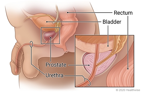 Male pelvic organs, showing the prostate, bladder, urethra, and rectum, with detail showing the urethra passing through the prostate.