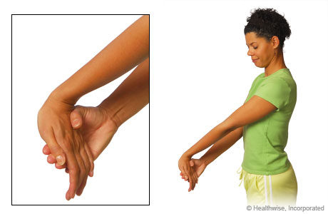 The wrist flexor stretch