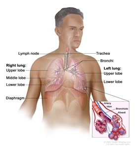 Respiratory system anatomy; drawing shows the right lung with the upper, middle, and lower lobes, the left lung with the upper and lower lobes, and the trachea, bronchi, lymph nodes, and diaphragm. An inset shows the bronchioles, alveoli, artery, and vein.