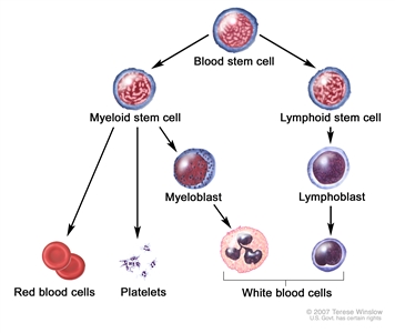 Blood cell development; drawing shows the steps a blood stem cell goes through to become a red blood cell, platelet, or white blood cell. Drawing shows a myeloid stem cell becoming a red blood cell, platelet, or myeloblast, which then becomes a white blood cell. Drawing also shows a lymphoid stem cell becoming a lymphoblast and then one of several different types of white blood cells.