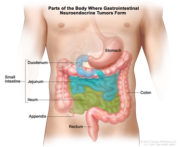 Drawing of the gastrointestinal tract showing the stomach, small intestine (including the duodenum, jejunum, and ileum), appendix, colon, and rectum.