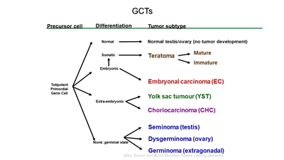 Diagram showing extracranial germ cell development from primordial germ cells.