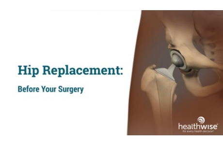 Hip Replacement: Before Your Surgery
