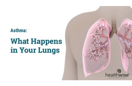 Asthma: What Happens in Your Lungs
