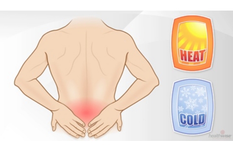 Heat or Ice for Low Back Pain