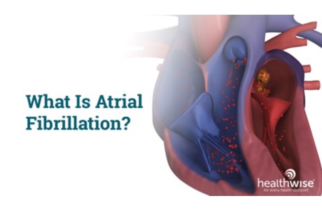 What Is Atrial Fibrillation?