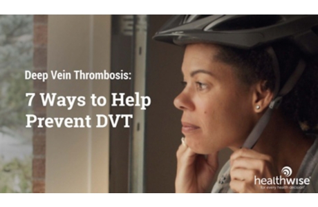Deep Vein Thrombosis: 7 Ways to Help Prevent DVT