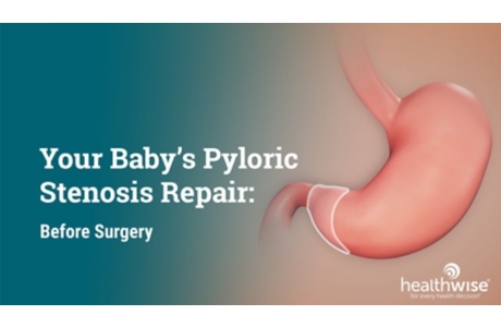 Your Baby's Pyloric Stenosis Repair: Before Surgery