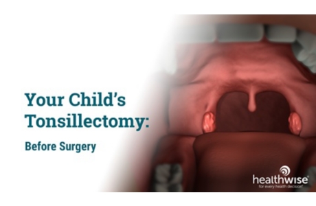 Your Child's Tonsillectomy: Before Surgery