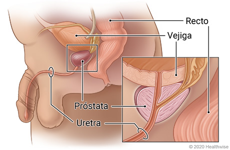 Ubicación de la próstata debajo de la vejiga y al lado del recto, mostrando la uretra pasando a través de la próstata.