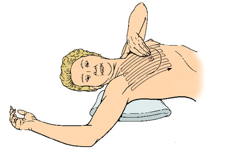Cómo hacer un autoexamen del seno siguiendo un patrón de arriba hacia abajo