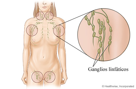 Ganglios linfáticos y su ubicación en el cuerpo