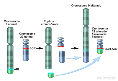 Cromosoma Filadelfia; en los tres paneles de la imagen se observa una sección del cromosoma 9 y una sección del cromosoma 22 que se rompen e intercambian lugares, creando un cromosoma 22 alterado llamado cromosoma Filadelfia. En el panel izquierdo, se muestra el cromosoma 9 normal con el gen ABL y el cromosoma 22 normal con el gen BCR. En el panel central, se muestra el cromosoma 9 que se separa a la altura del gen ABL y el cromosoma 22 que se separa por debajo del gen BCR. En el panel derecho, se muestra el cromosoma 9 unido a la sección del cromosoma 22 y el cromosoma 22 con la sección del cromosoma 9 que contiene parte del gen ABL unido. El cromosoma 22 alterado con el gen BCR-ABL se llama cromosoma Filadelfia.