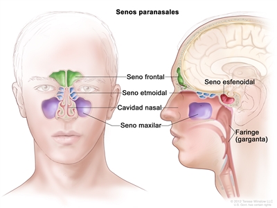 Anatomía de los senos paranasales. En la imagen se observan vistas frontales y laterales del seno frontal, el seno etmoidal, el seno maxilar y el seno esfenoidal. También se muestran la cavidad nasal y la faringe (garganta).