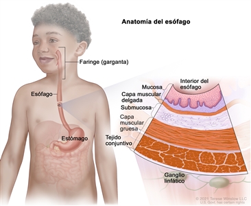 Anatomía del esófago; en la imagen se observan la faringe (garganta), el esófago y el estómago. En una ampliación, se muestran la mucosa, la capa muscular delgada, la submucosa, la capa muscular gruesa y el tejido conjuntivo de la pared del esófago. También se muestran ganglios linfáticos.