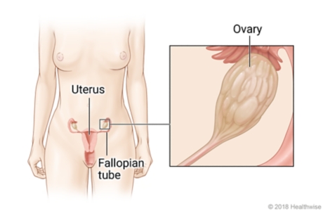 Location of uterus, ovaries, and fallopian tubes in lower belly, with close-up of ovary
