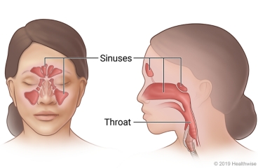 Sinuses in face viewed from front, and side view showing connection to throat.