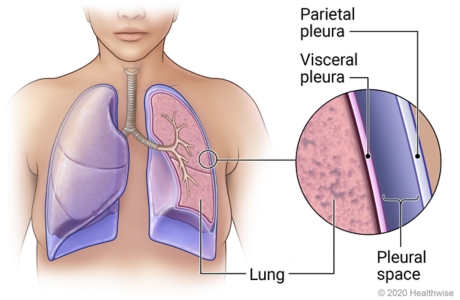 lung anatomy pleura