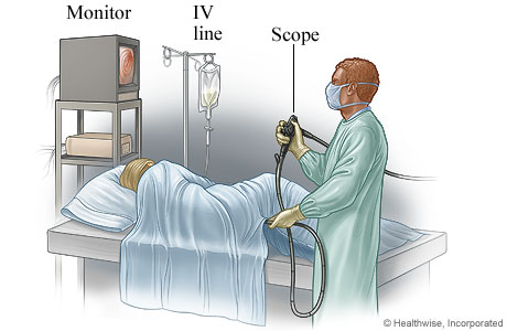 A person having a sigmoidoscopy