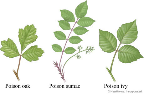 Leaves of poison oak, sumac, and ivy