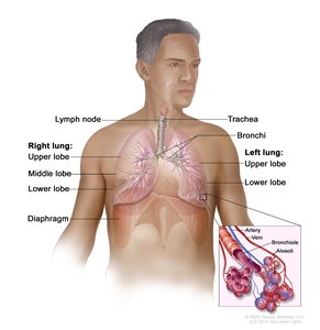 Respiratory anatomy; drawing shows right lung with upper, middle, and lower lobes; left lung with upper and lower lobes; and the trachea, bronchi, lymph nodes, and diaphragm. Inset shows bronchioles, alveoli, artery, and vein.