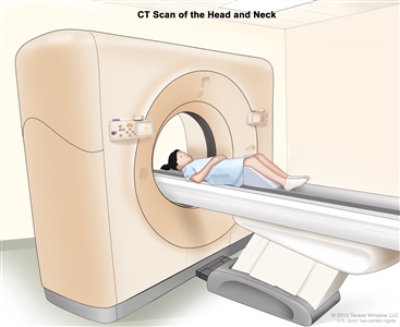 Computed tomography (CT) scan of the head and neck; drawing shows a child lying on a table that slides through the CT scanner, which takes x-ray pictures of the inside of the head and neck.