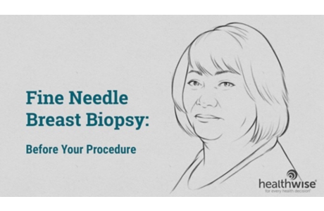 Fine Needle Breast Biopsy: Before Your Procedure