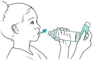 El niño sujeta el inhalador y la cámara de inhalación mientras exhala.