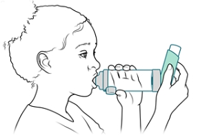 Niño con los labios bien cerrados alrededor de la boquilla de la cámara de inhalación.