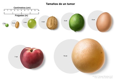 Tamaños de un tumor. En la imagen se observan diferentes tamaños de un tumor en centímetros (cm) que se comparan con el tamaño de una arveja (1 cm), un maní (2 cm), una uva (3 cm), una nuez (4 cm), una lima (5 cm), un huevo (6 cm), un durazno (7 cm) y un pomelo (10 cm). También se muestra una regla de 10 cm y una regla de 4 in.