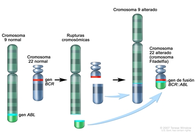 Cromosoma Filadelfia. En la imagen se observa que una sección del cromosoma 9 y una sección del cromosoma 22 se separan e intercambian lugares, creando un cromosoma 22 alterado llamado cromosoma Filadelfia. En el lado izquierdo, se muestra el cromosoma 9 normal que contiene el gen ABL y el cromosoma 22 normal que contiene el gen BCR. En el centro, se muestra el gen ABL separándose del cromosoma 9 y una sección del cromosoma 22 que se separa por debajo del gen BCR. En el lado derecho, se muestra el cromosoma 9 unido a una sección del cromosoma 22 y una versión más pequeña del cromosoma 22 con la sección del cromosoma 9 que contiene parte del gen ABL unido. El gen ABL se une al gen BCR en el cromosoma 22 y forma el gen de fusión BCR::ABL. El cromosoma 22 alterado que contiene el gen BCR::ABL se llama cromosoma Filadelfia.