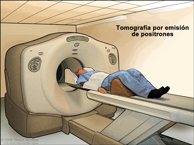 Tomografía por emisión de positrones (TEP). En la imagen se observa a un paciente acostado en una camilla que se desliza a través de una máquina de TEP.
