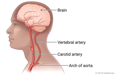 Inside view of head and neck, showing brain, cerebral artery, carotid artery, vertebral artery, and arch of the aorta