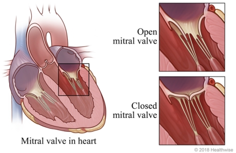 Location of mitral valve in heart, with detail of open and closed mitral valves