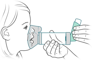 Mask spacer placed securely over child's mouth and nose.