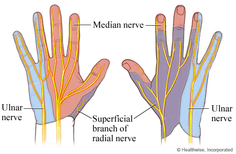 Ulnar Neuropathy at the Elbow (Cubital Tunnel Syndrome) – Neuromuscular and  Electrodiagnostic Clinic