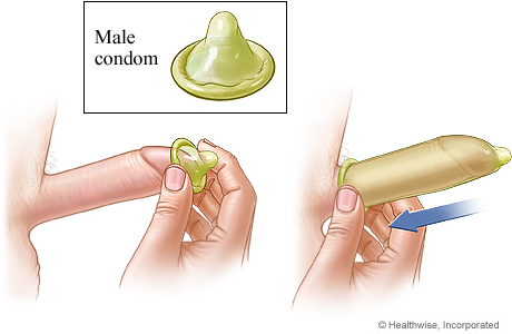 Male condom method of birth control