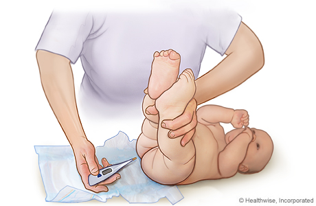 Rectal Thermometer: When and How to Use One