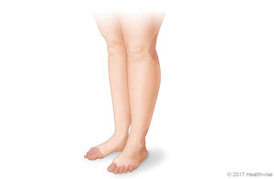 Places on the legs and feet where rashes are common