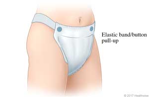 Pull-up adult underwear with elastic bands that attach to the front.