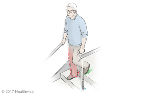 Going down stairs with a cane.