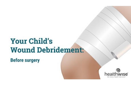 Your Child's Wound Debridement: Before Surgery